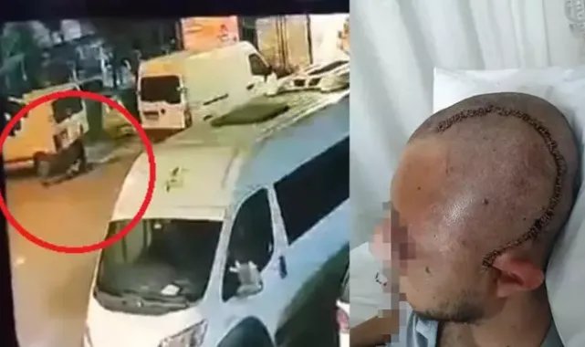 Parkta içki içen çalışanını sopayla dövmekten suçlanan patrona 15 yıl hapis istemi