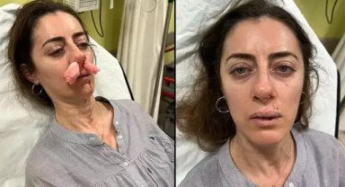 Kendisini eşinin sevgilisi zanneden kadın tarafından darbedildi