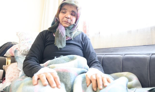 Kızlarının evine ziyarete giden anne ve baba köpeğin saldırısına uğradı