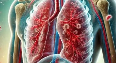 Prof. Dr. Özlü: Verem hastalığının teşhisi kolay, tedavisi de var