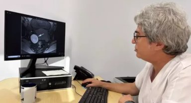 ‘Çikolata kisti olarak bilinen endometrioziste gizli tehlike; eşlik eden hastalıklar’