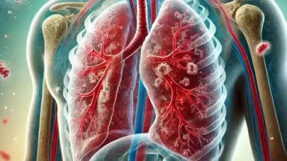 Türkiye'de tüberküloz oranı düşüşte