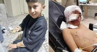 Bakkala giderken köpeklerin saldırısına uğrayan Murat, ağır yaralandı