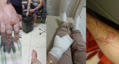 Hakkari’de lavabo açıcı patladı: İki kardeşin vücudunda yanıklar oluştu