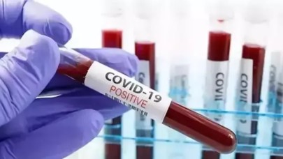 ABD’de her hafta 300’den fazla kişi Covid-19 nedeniyle hayatını kaybediyor