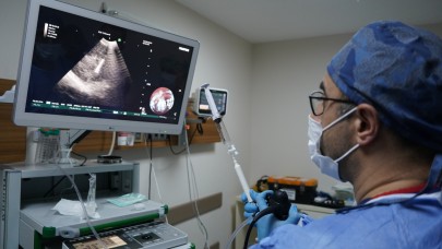 İEÜ Medical Point Hastanesi Akciğer Sağlığı Merkezi'nde EBUS ile ameliyatsız tanı
