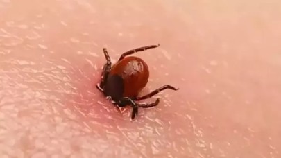 Bolu'da kenenin ısırdığı kadın öldü