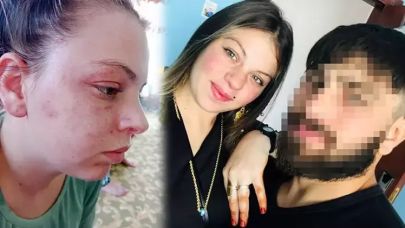 Kendisini darbeden milli sporcu eşinden şikayetçi oldu