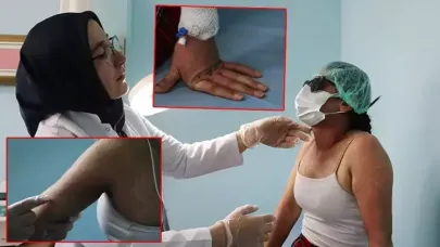 İnternetten sipariş verdiği krem hastanelik etti