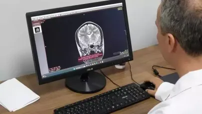Prof. Dr. Terzi: Her unutkanlık Alzheimer hastalığı değildir