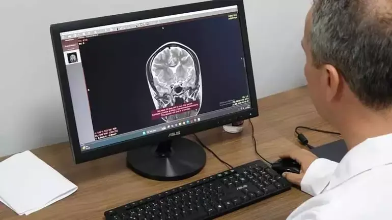 Prof. Dr. Terzi: Her unutkanlık Alzheimer hastalığı değildir