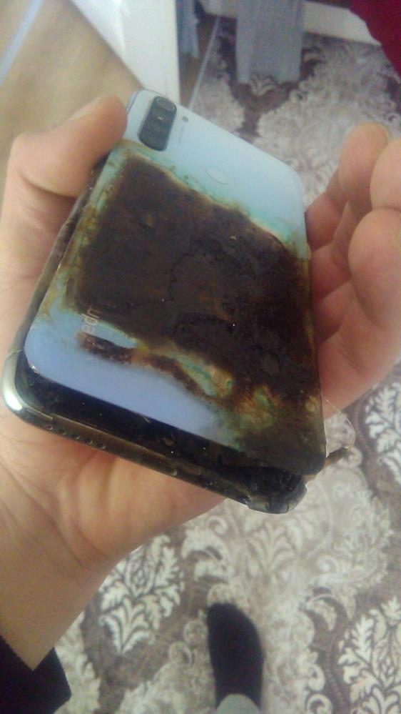 Patlayan cep telefonu yaraladı