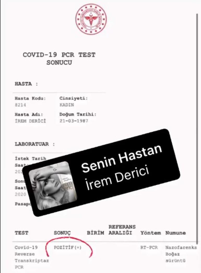 İrem Derici korona virüse yakalandı