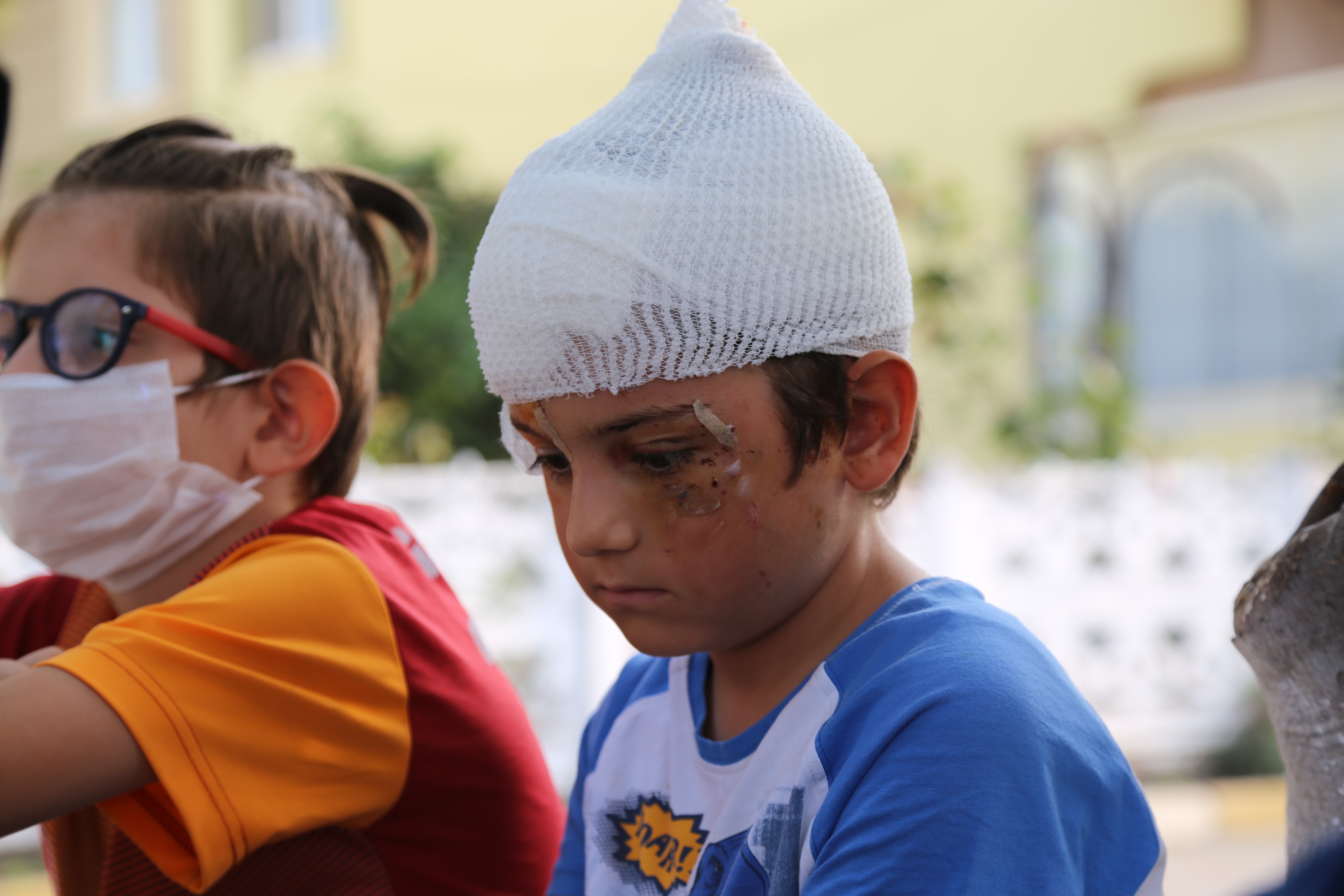 Kangal saldırdı, 52 dikiş atıldı