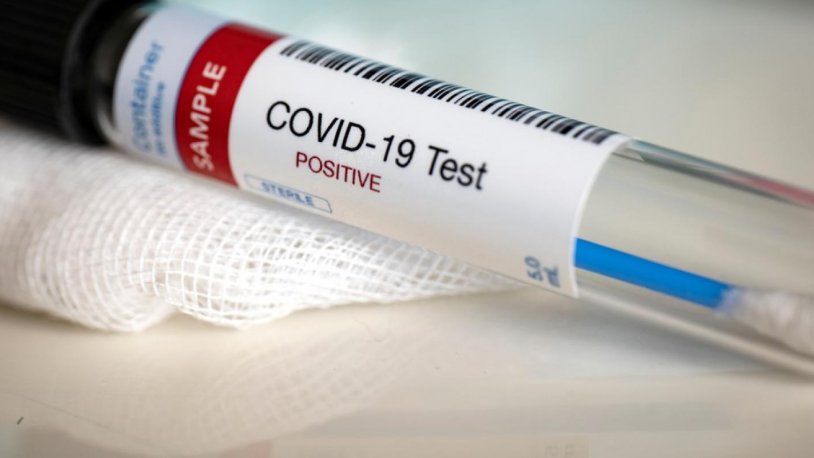 Düzce Valisi Atay'ın koronavirüs testi pozitif çıktı