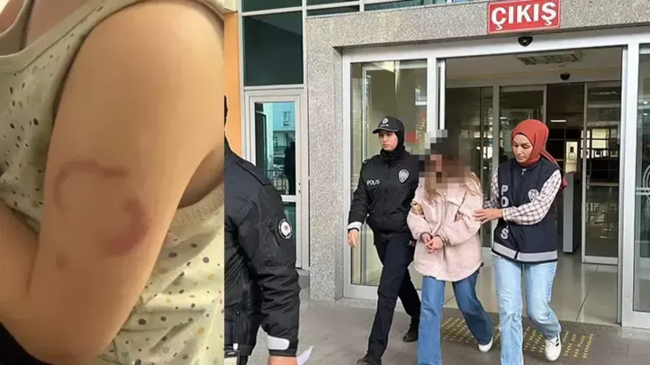 3 yaşındaki öğrencisinin kolunu ısıran öğretmen tutuklandı
