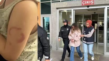 3 yaşındaki öğrencisinin kolunu ısıran öğretmen tutuklandı