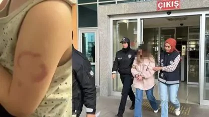 3 yaşındaki öğrencisinin kolunu ısıran öğretmen tutuklandı