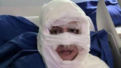 Kadının üzerine yanıcı madde döküp yaktıktan sonra kaçtı