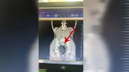 Yolcunun midesinden 472 gram metamfetamin çıktı