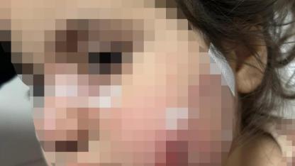 İzmir'de köpek dehşeti: 3 yaşındaki Ada yaralandı