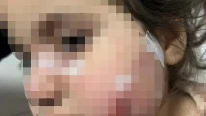 İzmir'de köpek dehşeti: 3 yaşındaki Ada yaralandı