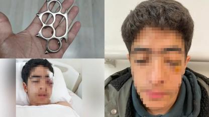 Akran zorbalığına bir yenisi eklendi