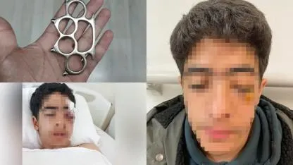 Akran zorbalığına bir yenisi eklendi