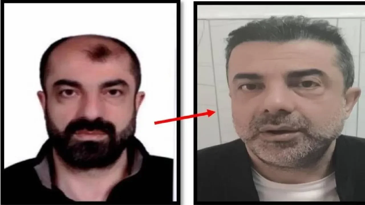 Ameliyat ile yüzünü değiştirdi firari olarak yaşadı