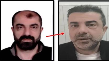 Ameliyat ile yüzünü değiştirdi firari olarak yaşadı