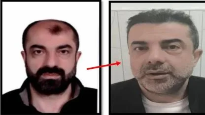 Ameliyat ile yüzünü değiştirdi firari olarak yaşadı