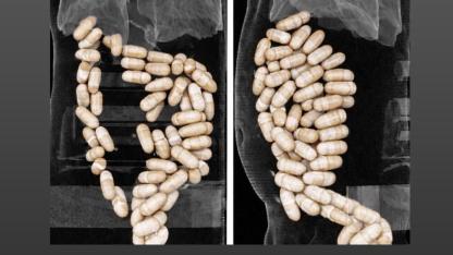 Midesinde uyuşturucu taşıyan şüpheliler tutuklandı