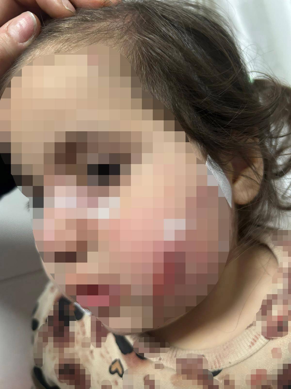 İzmir'de köpek dehşeti: 3 yaşındaki Ada yaralandı