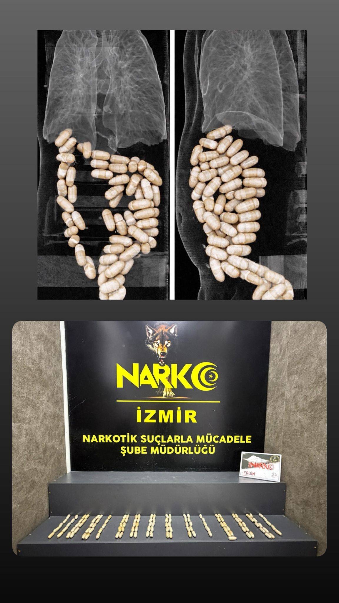 Midesinde uyuşturucu taşıyan şüpheliler tutuklandı